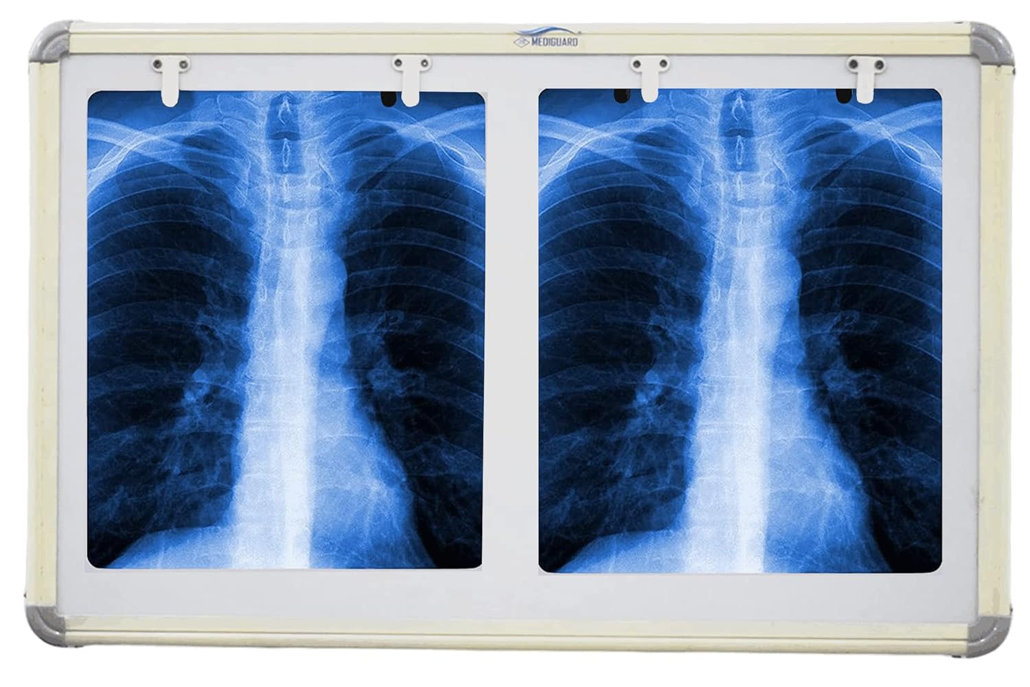 MEDIGUARD Premium Xray View Box, Double Film LED X-Ray View Box with Automatic Film Activation Censor and Variable Brightness Controller Pack of 1, 28X17 Inch