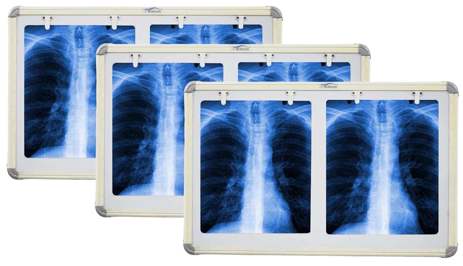 MEDIGUARD Combo of Premium Xray View Box, Double Film LED X-Ray View Box with Automatic Film Activation Censor and Variable Brightness Controller Pack of 3, 28X17 Inch