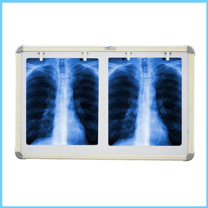 MEDIGUARD Double Film LED X-Ray View Box with Automatic Film Activation Censor and Variable Brightness Controller, 28X17 Inch